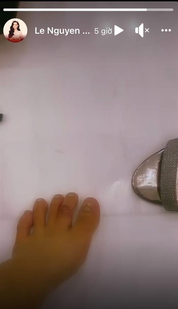 Bảo Ngọc tiết lộ đầm chung kết Miss Intercontinental hậu chấn thương-4