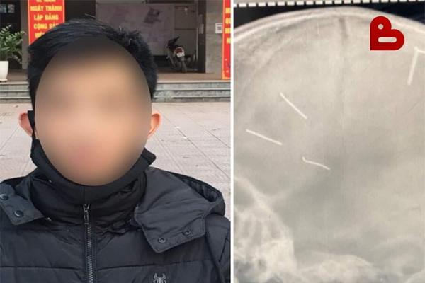 NÓNG: Đang xét xử kẻ đóng 9 cái đinh vào đầu bé 3 tuổi-7