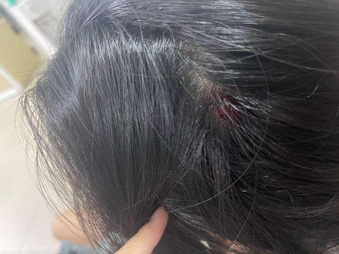 Người phụ nữ mang thai ở Hải Phòng bị hàng xóm đánh nhập viện-2