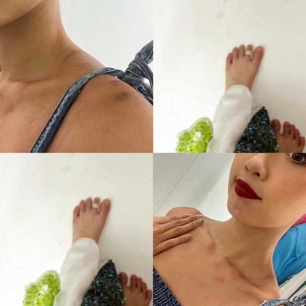 Bảo Ngọc nói gì về sự cố gãy cánh ở Miss Intercontinental?-10