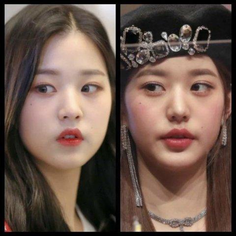 Mỹ nhân 18 tuổi Jang Won Young bị chỉ ra bằng chứng tiêm môi-1