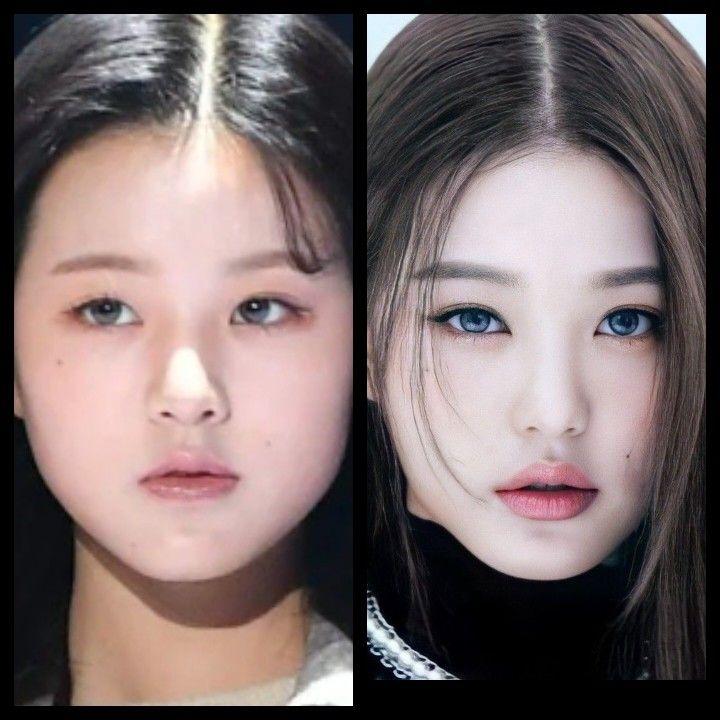 Mỹ nhân 18 tuổi Jang Won Young bị chỉ ra bằng chứng tiêm môi-2