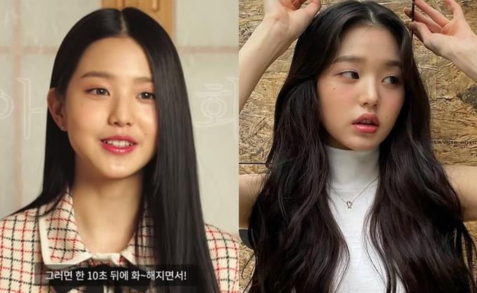 Mỹ nhân 18 tuổi Jang Won Young bị chỉ ra bằng chứng tiêm môi-3