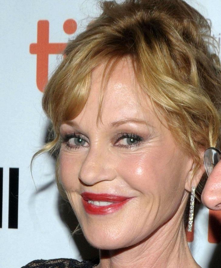 7 sao nữ ân hận sau khi nhờ cậy dao kéo-5