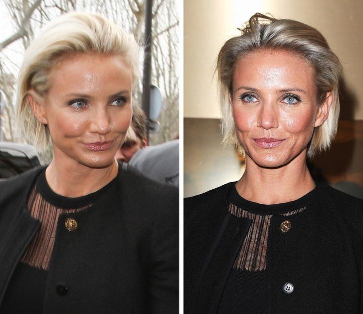 7 sao nữ ân hận sau khi nhờ cậy dao kéo-7