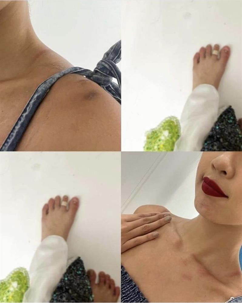 Bảo Ngọc bầm dập, bung móng trước chung kết Miss Intercontinental-2