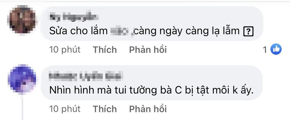 Ngọc Châu bị nghi thẩm mỹ khi xuất hiện với mặt tiền đơ cứng-11