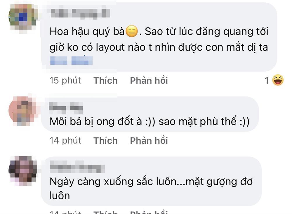 Ngọc Châu bị nghi thẩm mỹ khi xuất hiện với mặt tiền đơ cứng-9