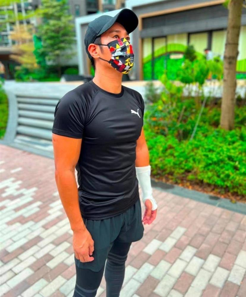 Tình hình sức khỏe tài tử Hong Kong sau khi bị chém vào mặt-2