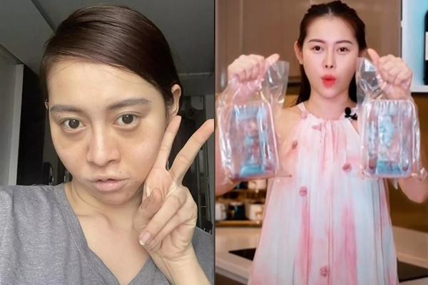 Gương mặt biến dạng của chị Google Việt Phương Thoa gây xôn xao-7