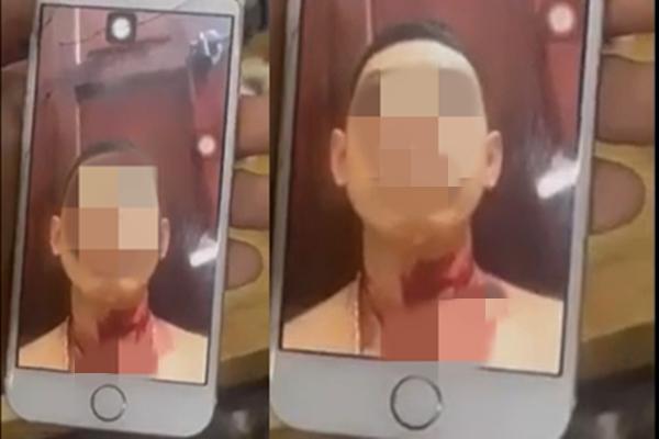 Nam sinh cầm dao đâm bạn gái trọng thương rồi cứa cổ tự sát-2