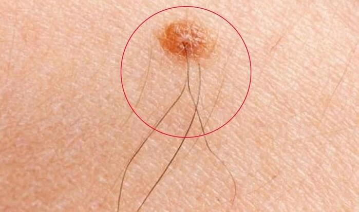 3 vị trí lông mọc càng nhiều càng dễ tụ lộc, hậu vận phú quý-1