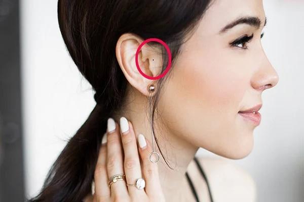 4 nốt ruồi làm rò rỉ tiền bạc, nên xóa càng sớm càng tốt-5