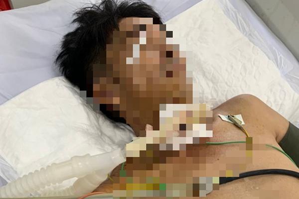 Cứu người đàn ông tự dùng dao cứa cổ, đâm vào bụng-1