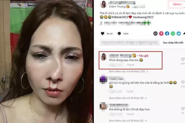 Đỗ Mỹ Linh đăng clip chồng đánh vẹo mũi bị nhắc đến sợ-2