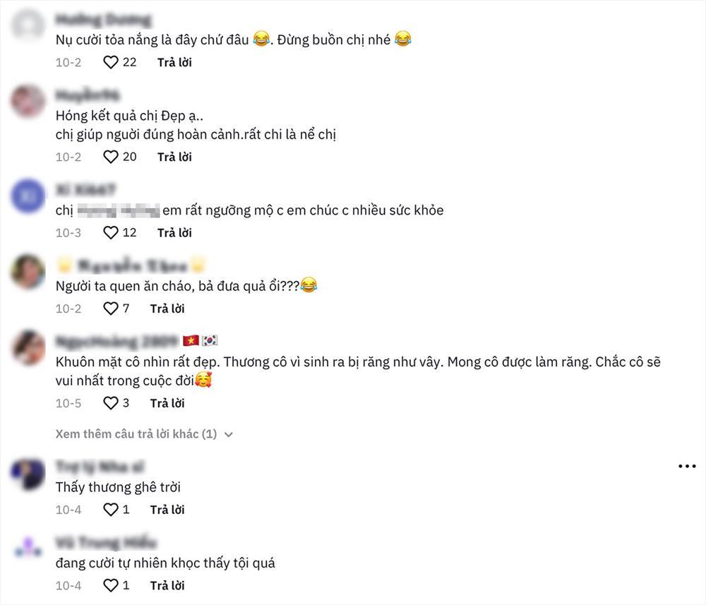 Người phụ nữ mang 10 triệu làm 4 chiếc răng vâu, thành quả ngất lịm-4