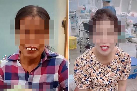 Người phụ nữ mang 10 triệu làm 4 chiếc 'răng vâu', thành quả ngất lịm