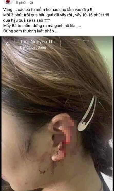 Clip: Vợ đánh ghen đạp vỡ kính, cắn đứt tai tiểu tam ở Thanh Hóa-2