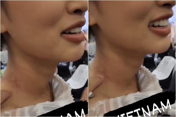 Thiên Ân bị thương ở cổ trước thềm Chung kết Miss Grand-4