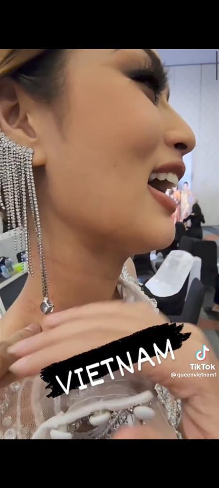 Thiên Ân bị thương ở cổ trước thềm Chung kết Miss Grand-5