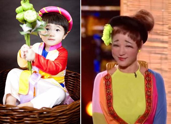 Thúy Nga sẽ thẩm mỹ cho con vì khuyết điểm lông mày chữ bát-3