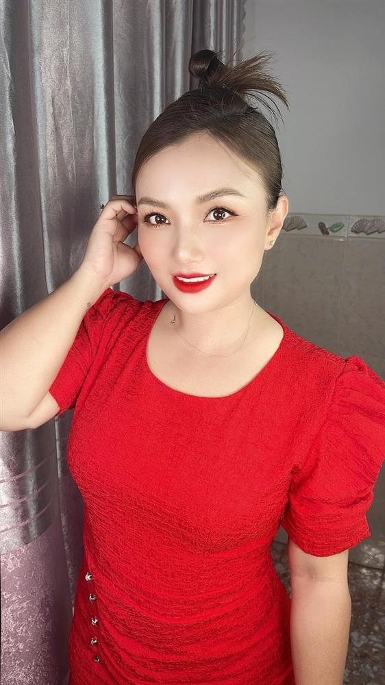 Quỳnh Trần JP xuất viện sau dao kéo, bất ngờ nhan sắc cam thường-7