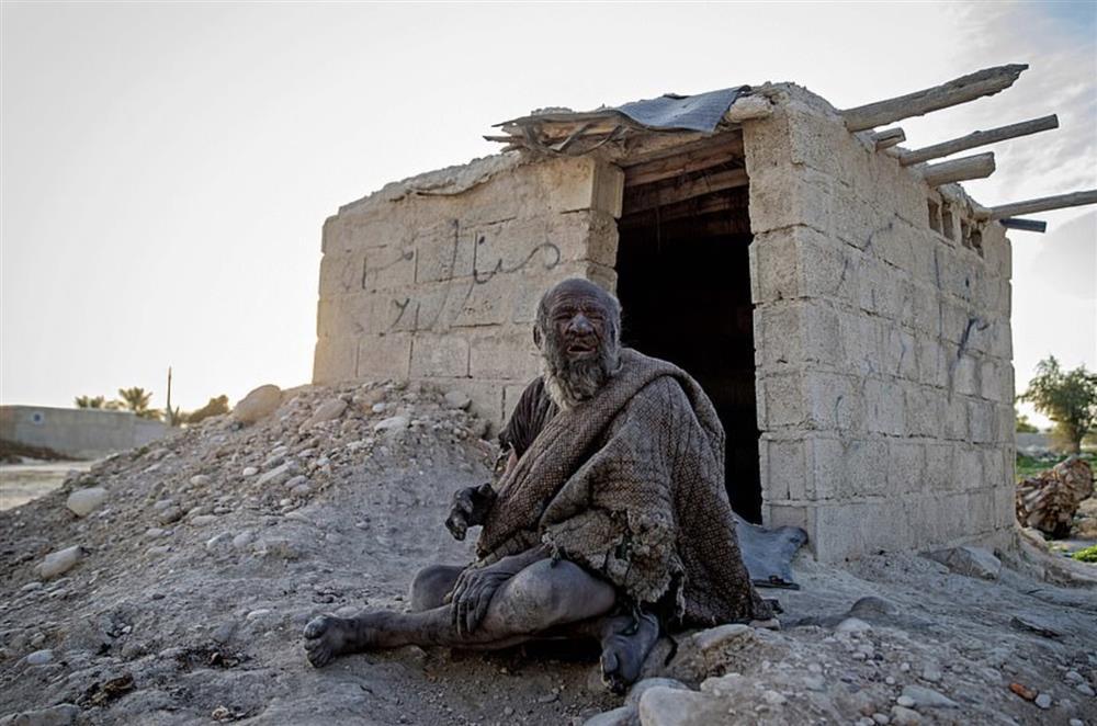 Người bẩn nhất thế giới qua đời sau khi tắm-2