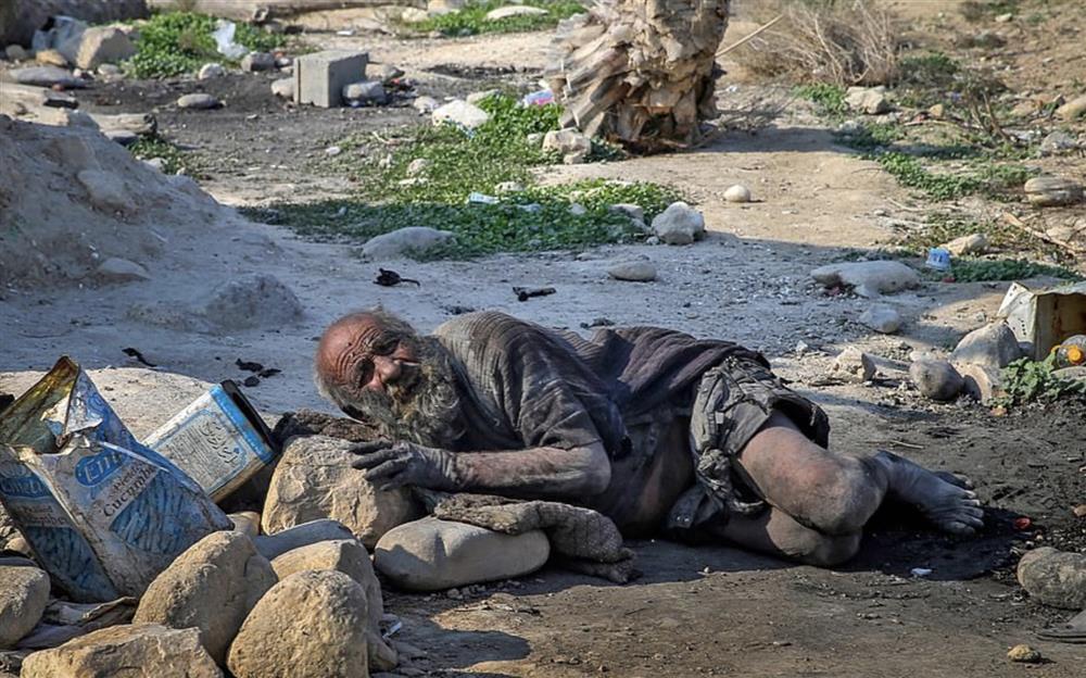 Người bẩn nhất thế giới qua đời sau khi tắm-5