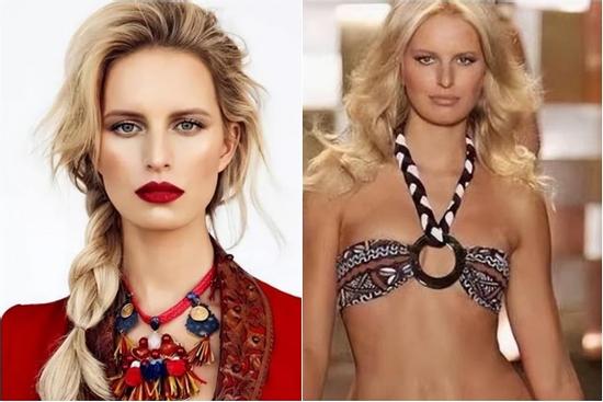 Siêu mẫu duy nhất không có rốn nhưng vẫn xinh đẹp