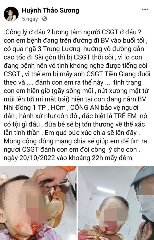 Xôn xao người mẹ tố CSGT đánh con gãy sống mũi, nứt xương mặt-1