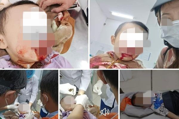 Nhiều tình tiết bất ngờ vụ cô giáo bị bẻ tay, đẩy ra khỏi lớp-3