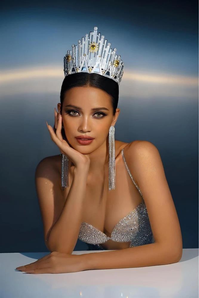 Ngọc Châu nói gì khi bị nghi đập mặt trước ngày đi thi?-1