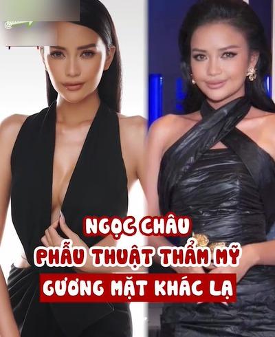 Ngọc Châu nói gì khi bị nghi đập mặt trước ngày đi thi?-2