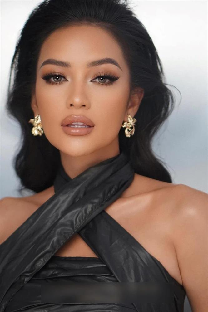 Ngọc Châu nói gì khi bị nghi đập mặt trước ngày đi thi?-7