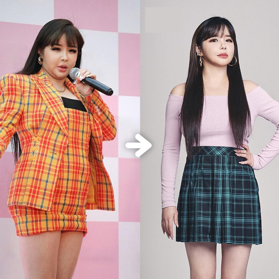 Tình trạng sức khỏe bất thường của Park Bom bắt nguồn từ lúc nào?-4