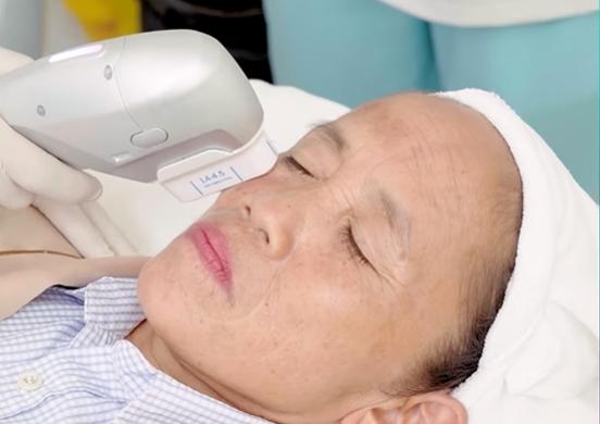 Bà Tân Vlog gây tranh cãi khi đi thẩm mỹ xóa nếp nhăn ở tuổi 55-3