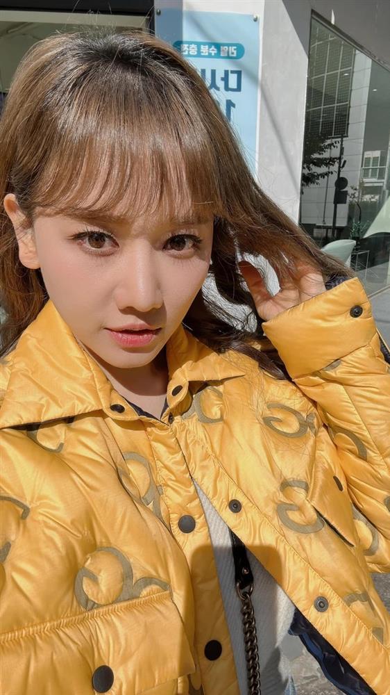 Hari Won tút tát lại nhan sắc hậu tiếp nhận điều trị bệnh liệt nửa mặt-2