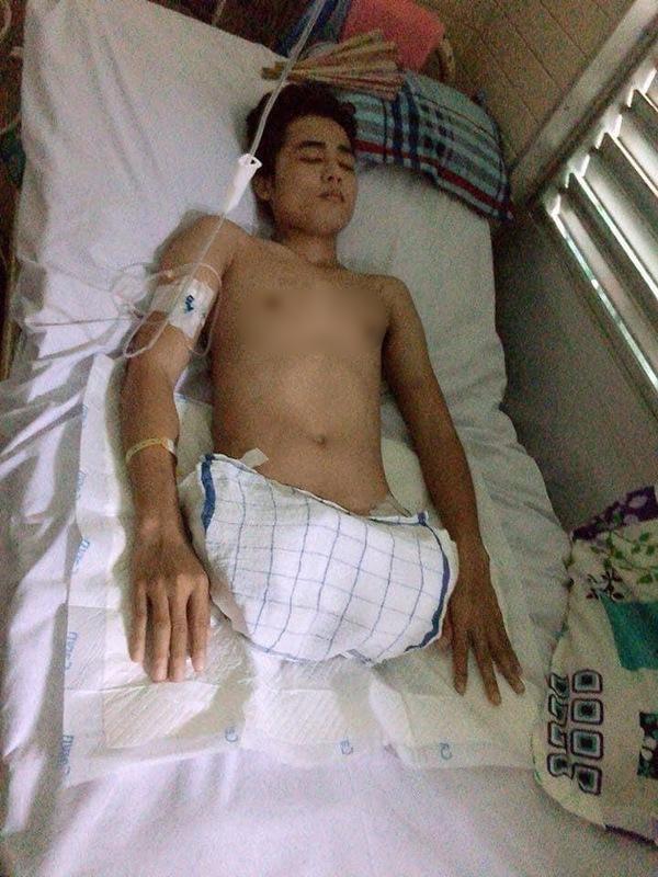 Nổi đình đám cuộc tình chênh lệch, chàng trai không chân giờ ra sao?-4