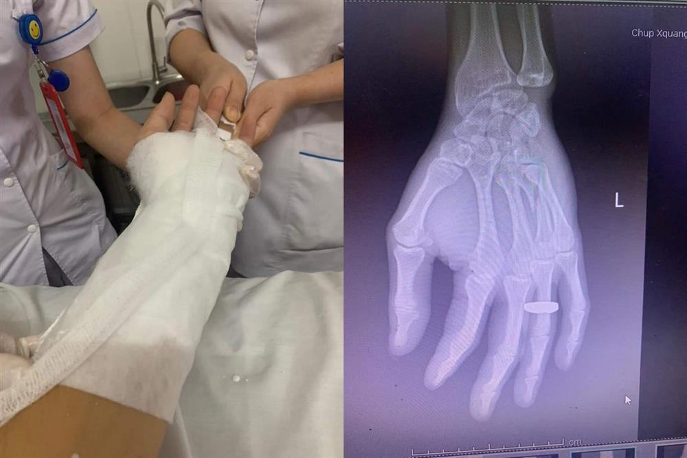 Clip: Nhân viên nhà xe đánh khách gãy tay vì dám chê vé đắt-3