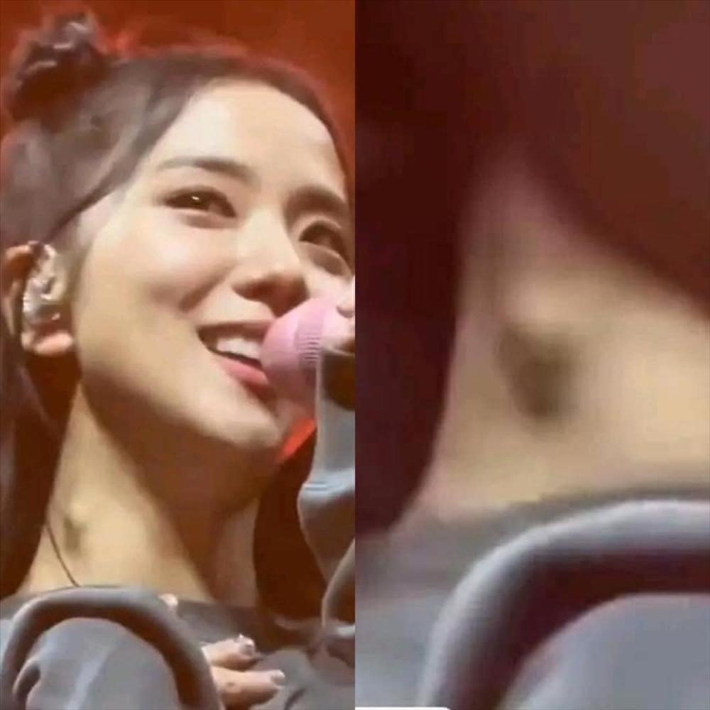 Jisoo lộ hạch sưng ở cổ, fan lo lắng khi BLACKPINK chạy tour dày đặc-1