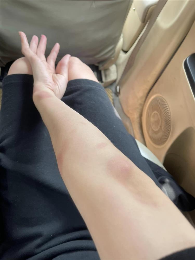 Tin showbiz Việt ngày 1/11: Diễm Hương bị thanh sắt rơi trúng người-3