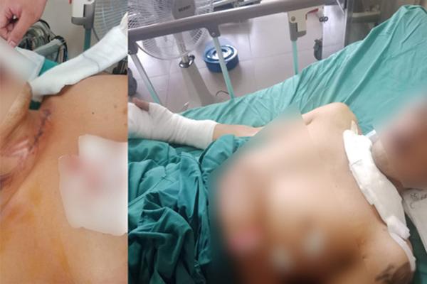 Thanh niên bị dây diều cứa rách cổ khi đang chạy xe máy trên cầu-1