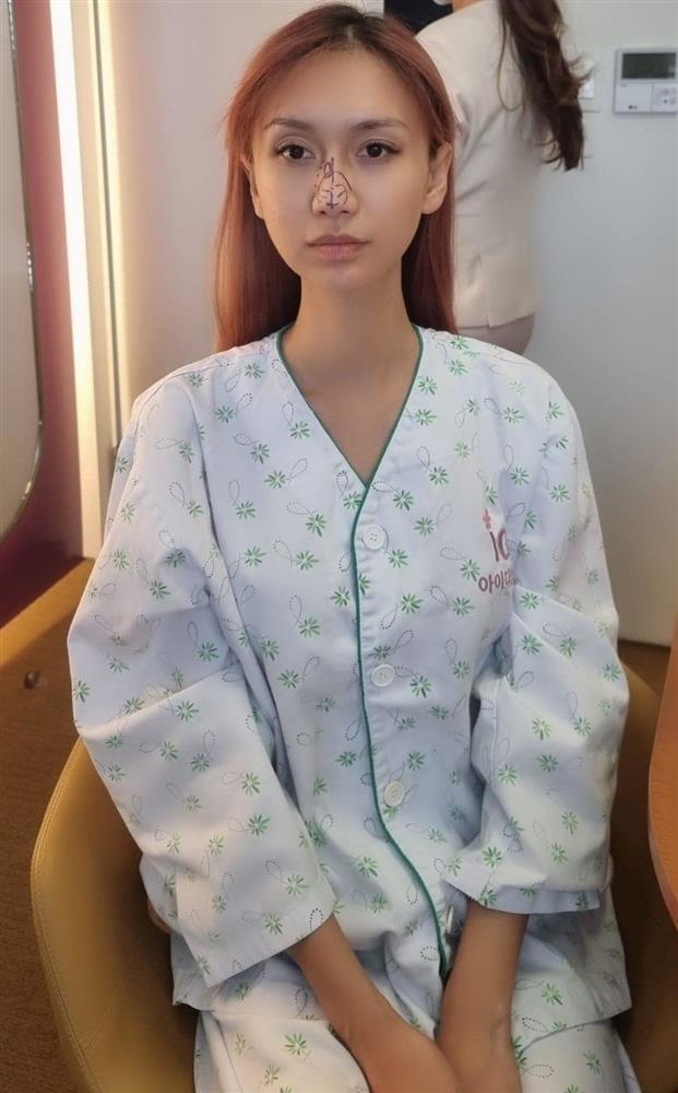 Lynk Lee tiếp tục sửa mũi sau khi hoàn thành giấc mơ chuyển giới-1