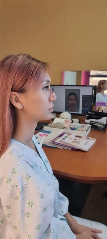 Lynk Lee tiếp tục sửa mũi sau khi hoàn thành giấc mơ chuyển giới-2