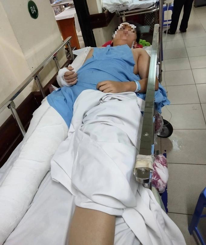 Bị bạn tụt quần trêu đùa, nam sinh lớp 9 uất ức nhảy từ tầng 3-2