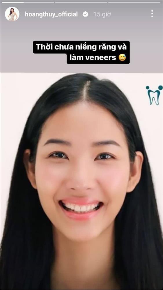 Nhan sắc Hoàng Thùy lên hẳn vài bậc khi chỉnh sửa một bộ phận-1