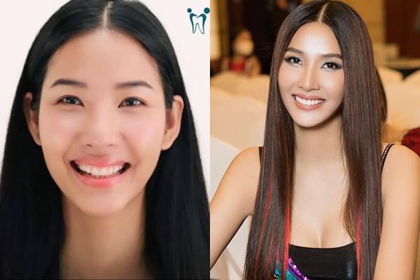 Đỗ Long phủ nhận liên quan status tiền bạc của Hoàng Thùy-7