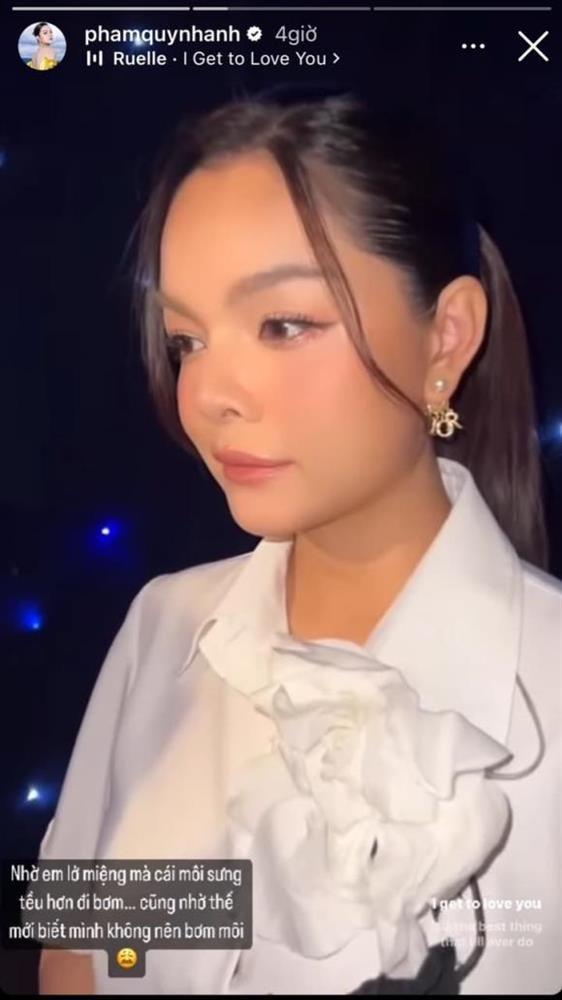 Phạm Quỳnh Anh lên tiếng khi bị nghi bơm môi tều sau sinh-2