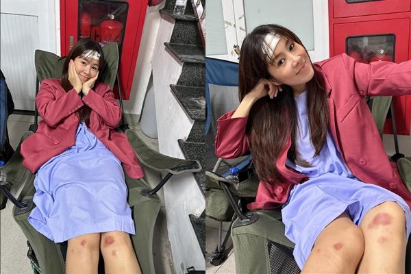 Lê Phương vừa hoàn thành phẫu thuật tim-5