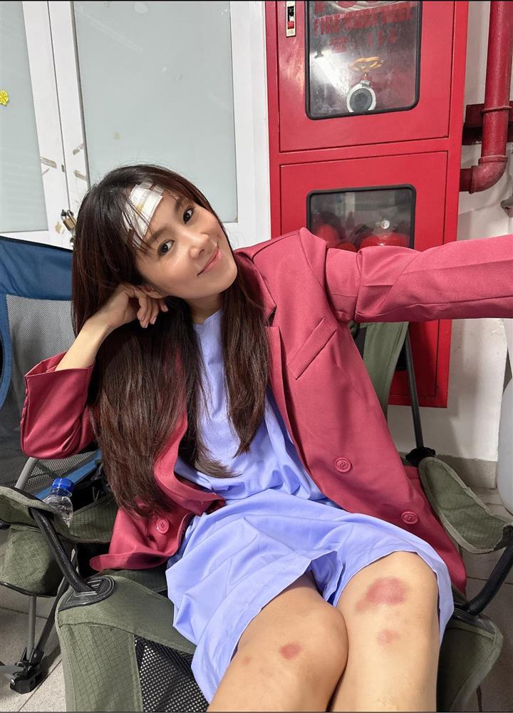 Lê Phương băng đầu bầm chân, ai nhìn cũng xót-1